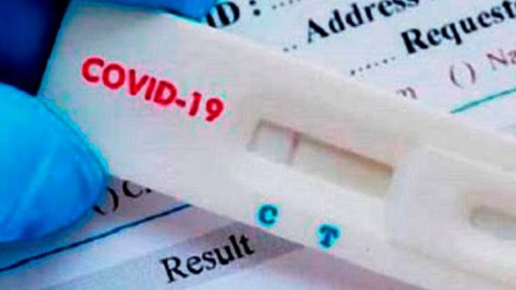 Autorizaron a vender en farmacias un test rápido de coronavirus: precio y cómo funciona